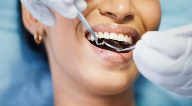 Best Emergency Wisdom Teeth Removal in Hanley Hills, MO
